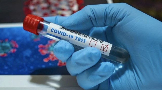 21 608 new coronavirus cases have been confirmed in Russia